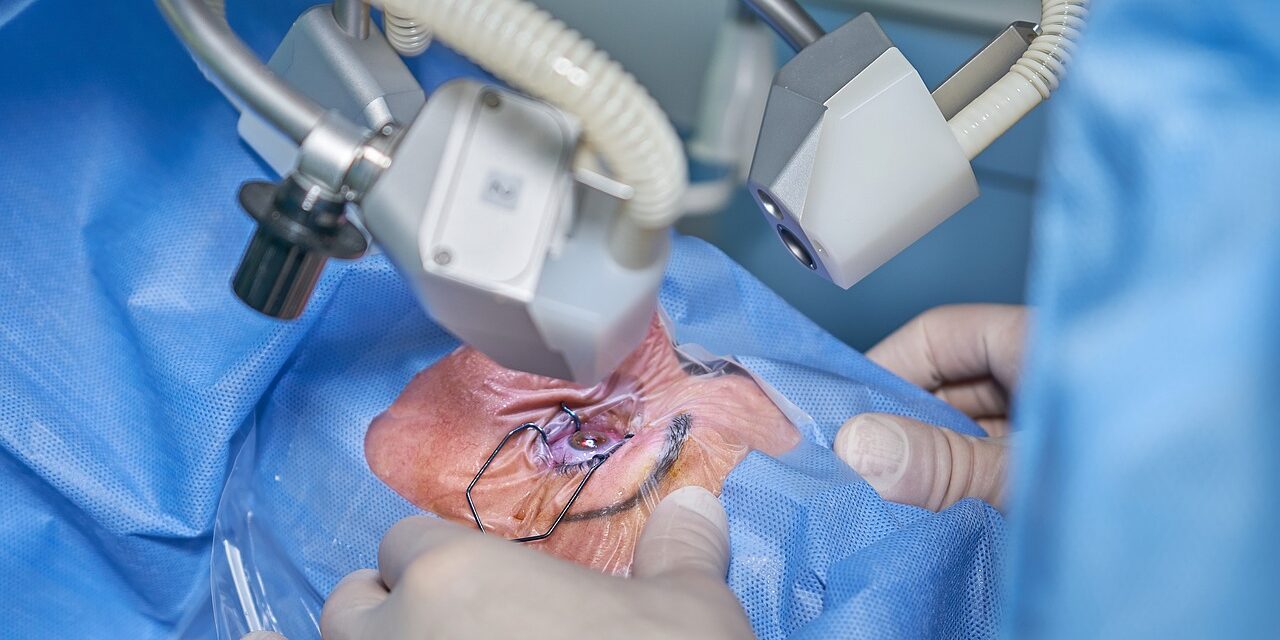 Explaining Laser Eye Surgery