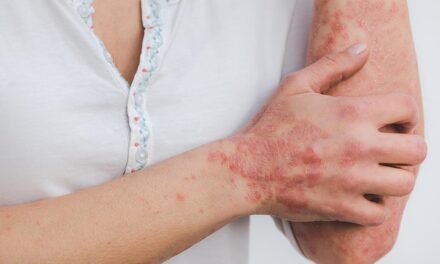 Psoriasis Awareness Month 2025: Raising Action and Understanding for Better Lives
